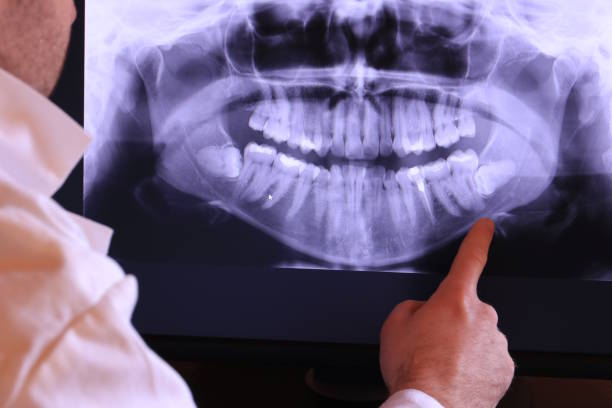Best Broken Tooth Emergency  in Laurel Bay, SC