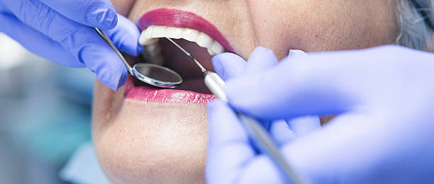 Best Knocked-Out Tooth Emergency  in Laurel Bay, SC